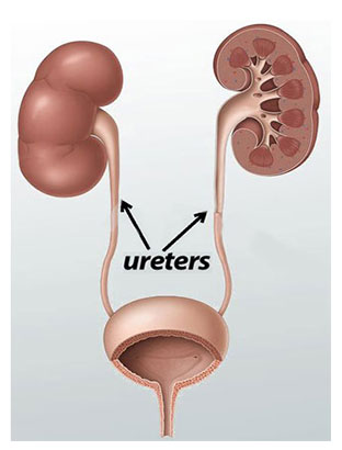 uretar